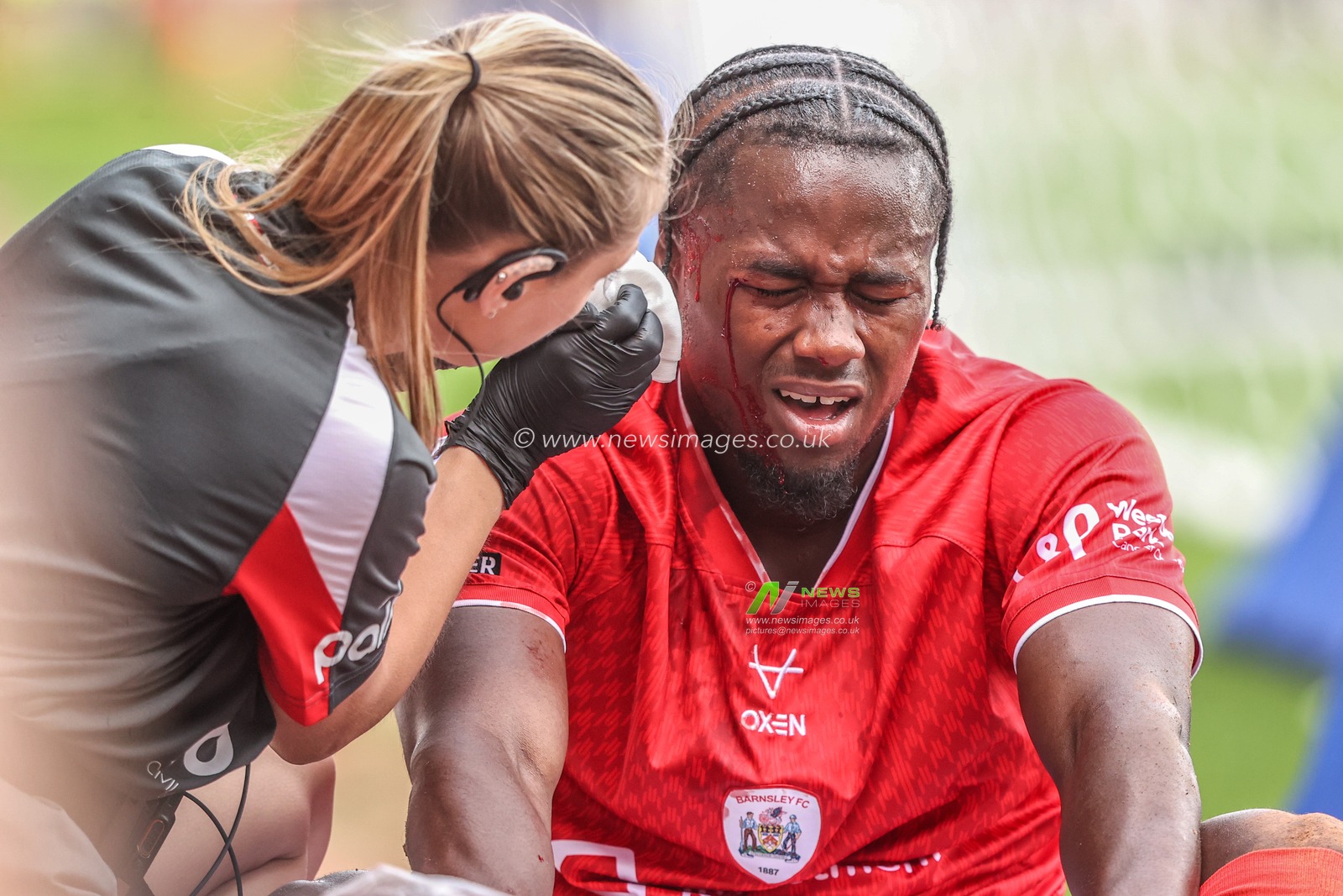 Reyes Cleary of Barnsley receives treatment for a head injury during the Sky Bet League One match Barnsley vs Bromley at Oakwell, Barnsley, United Kingdom on 15 August 2026

(Photo by Alfie Cosgrove/News Images)