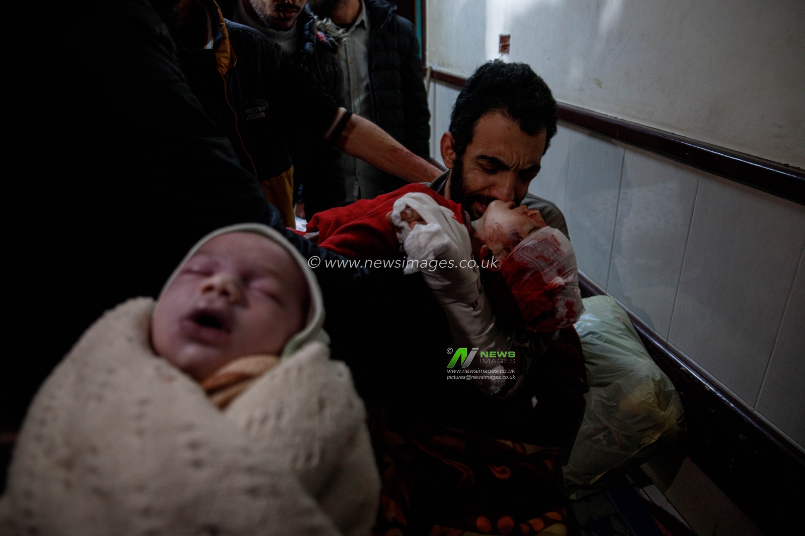 An injured father bids farewell to his son and daughter at Al-Aqsa Martyrs Hospital, who were killed in an Israeli bombing that targeted their home in Deir al-Balah this morning, in addition to their mother who was killed in the same attack.(Photo: Mohammed Skaik/News Images)