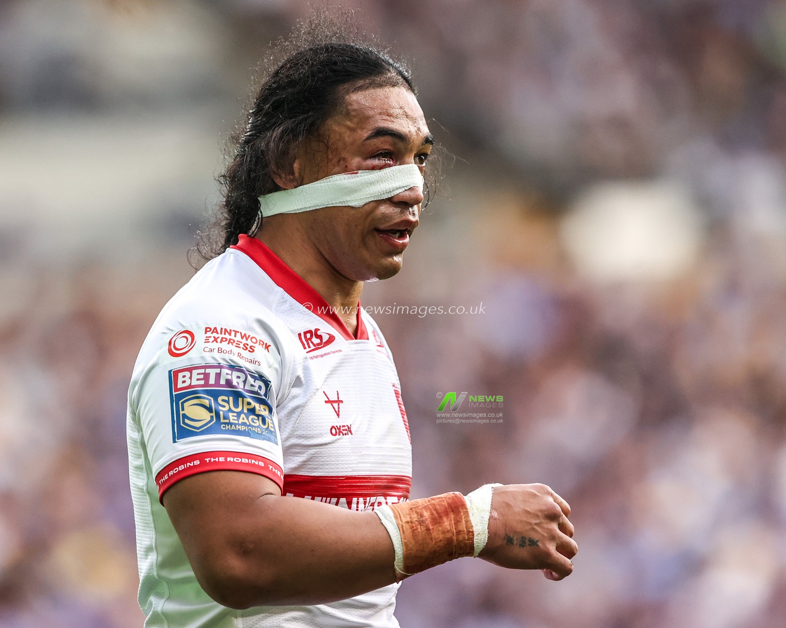 Tom Amone of Hull KR has his face bandaged up after an injury during the Betfred Super League round 16 match Leeds Rhinos vs Hull KR at AMT Headingley Stadium, Leeds, United Kingdom on 26 June 2026

(Photo by Alfie Cosgrove/News Images)