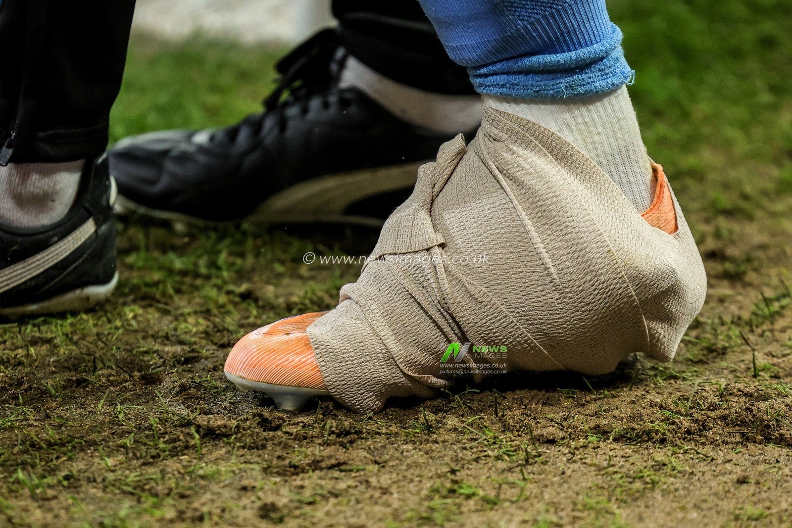 Hugo Bolin of Malmo FF has his foot wrapped up after an injury during the UEFA Europa League Matchday 5 of 8 Nottingham Forest vs Malmo FF at City Ground, Nottingham, United Kingdom, 27th November 2025

(Photo by Mark Cosgrove/News Images)

*** GER AUT SUI OUT ***